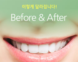 이렇게 달라집니다! Before & After